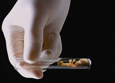 私人志愿者供卵助孕包生儿子生殖医学中心
